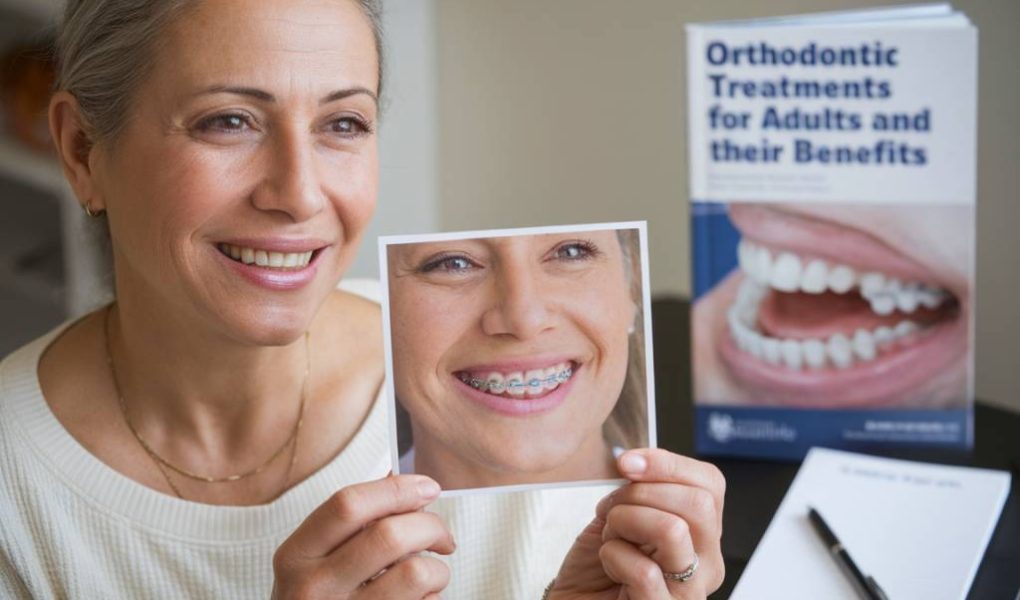 Les traitements d’orthodontie pour adultes et leurs bénéfices